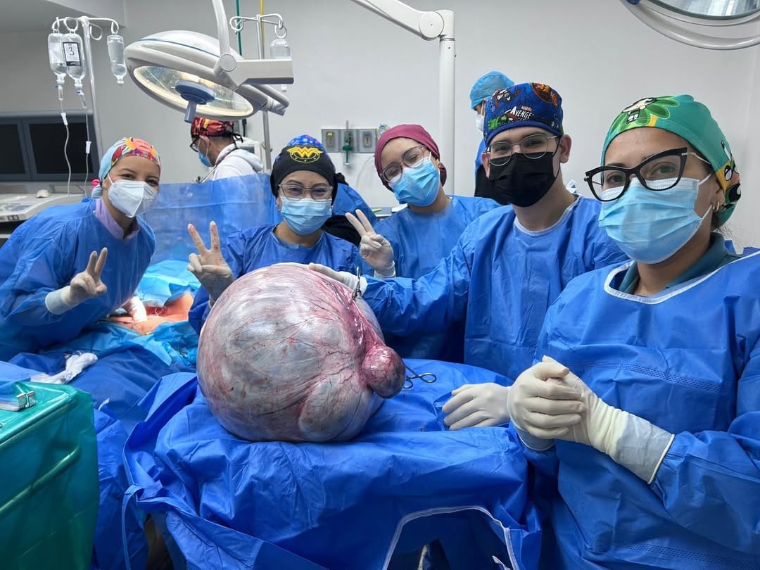 ANZOÁTEGUI | Cirujanos del Hospital Luis Razetti extrajeron un tumor de más de 25 kilos