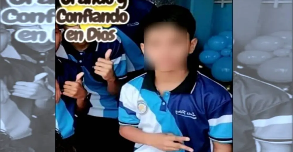 Menor sufrió graves quemaduras tras tocar guaya de alta tensión en Falcón