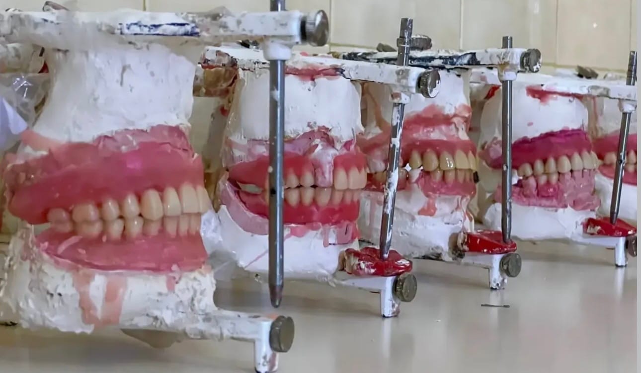 SUCRE | Jornada odontológica benefició a 50 pacientes con prótesis dentales en Cumaná