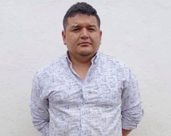 Imputaron al médico que amputó por error pierna sana de una mujer en Barinas