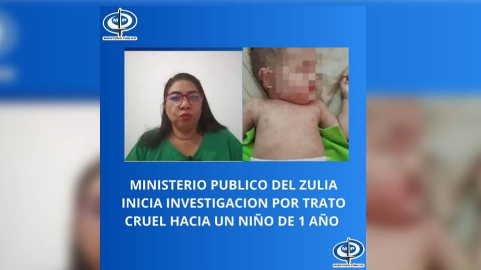 MP investigará caso de trato cruel hacia un bebé en Zulia
