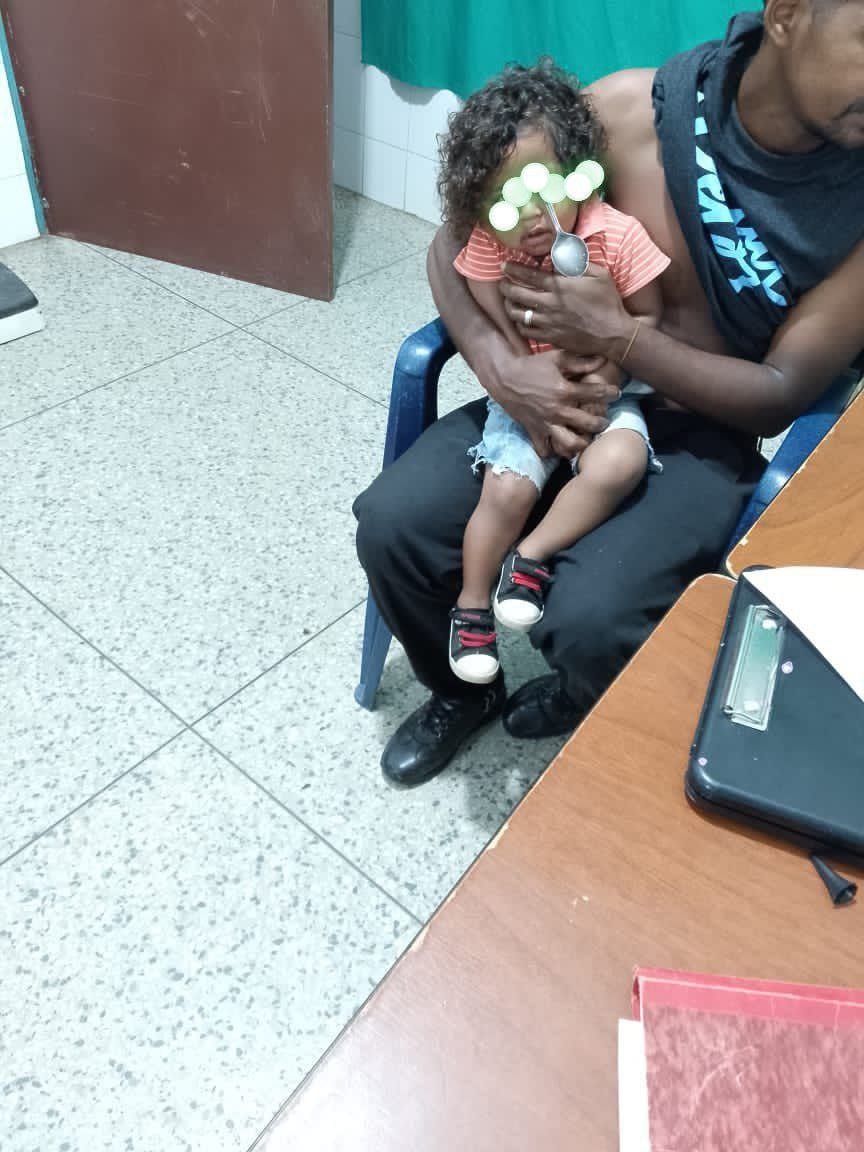 Niña sufrió lesión en un ojo tras enterrarse una cuchara en Bolívar