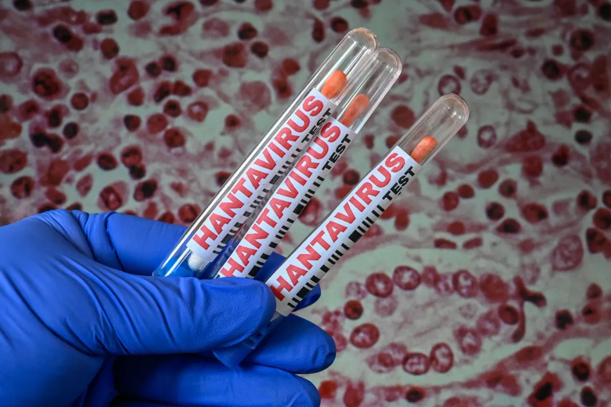 Academia Nacional de Medicina descarta alerta sanitaria por hantavirus en Venezuela