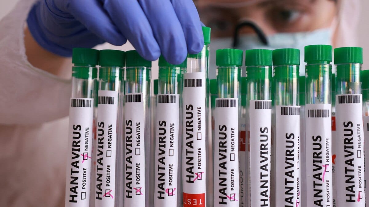Ministerio de Salud confirmó tres muertes por Hantavirus en el estado Anzoátegui