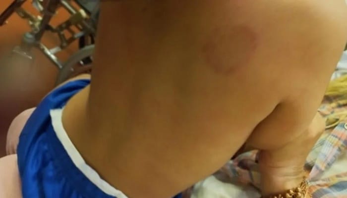 Detienen a mujer por agredir a mordiscos a su hijo de dos años