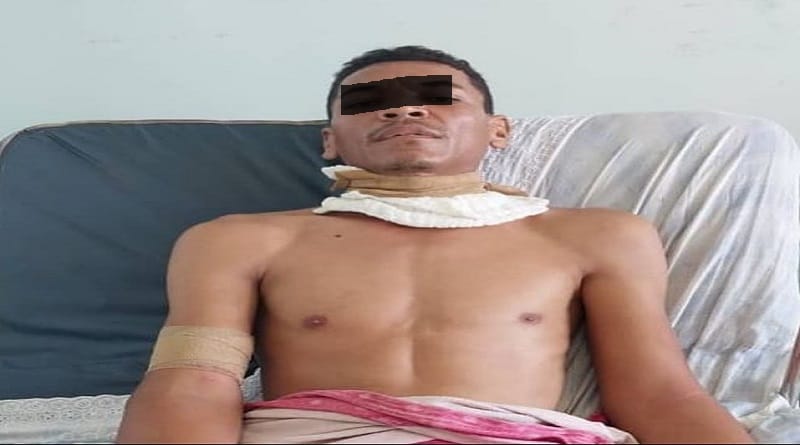 Capturado hombre por intento de femicidio en Lara