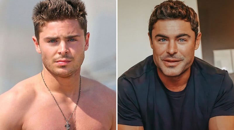 Zac Efron desmintió rumores sobre hacerse cirugías plásticas