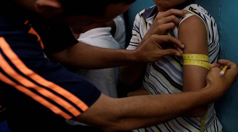 OCHA reveló que existen más de 8.000 niños con desnutrición aguda en Venezuela