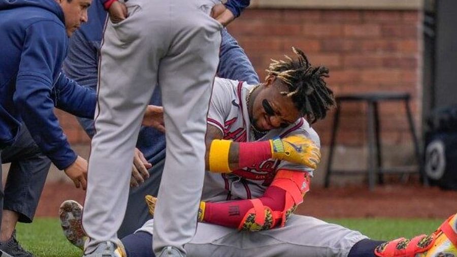 Ronald Acuña Jr sufrió lesión tras recibir un pelotazo