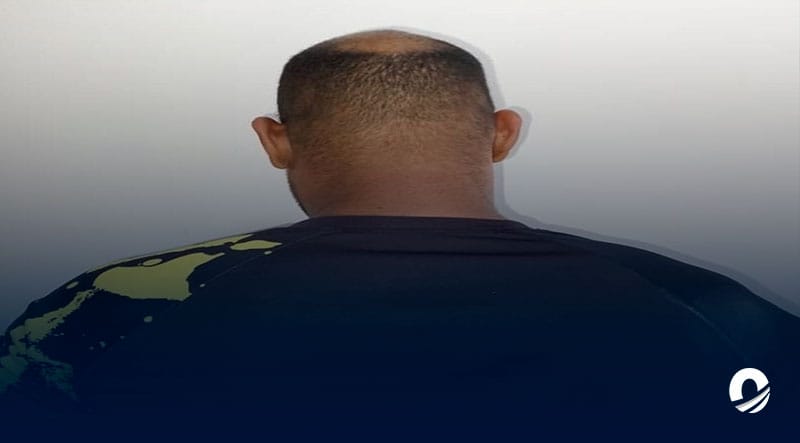 Detenido sujeto en Carúpano por presuntamente usurpar funciones como odontólogo