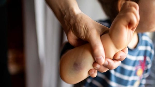 Niño de un año murió tras ser golpeado por su padrastro en Portuguesa