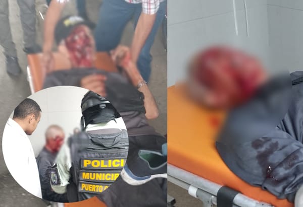 Adulto mayor resultó gravemente herido tras accidente en bicicleta en Carabobo