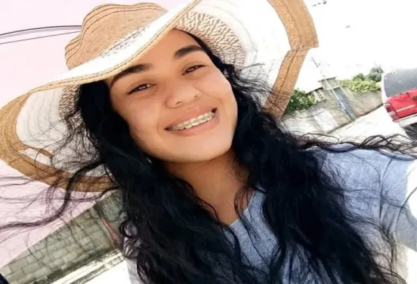 Enfermera que fue incendiada por su pareja en Yaracuy falleció tras pasar días hospitalizada