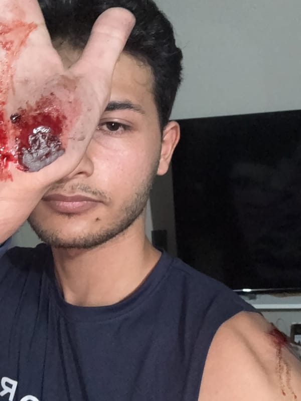 SUCRE | Creador de contenido de Cumaná denunció presunta agresión y genera repudio en redes sociales