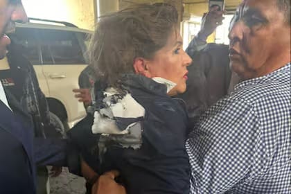 Diputada resultó herida en Honduras tras ser atacada con un explosivo