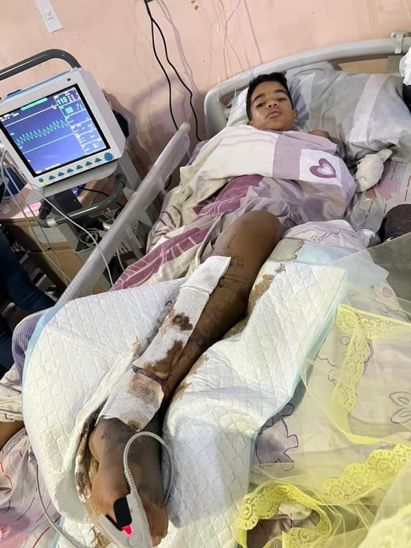 Piden ayuda para niño que fue mordido por una mapanare en Aragua: podría perder la pierna