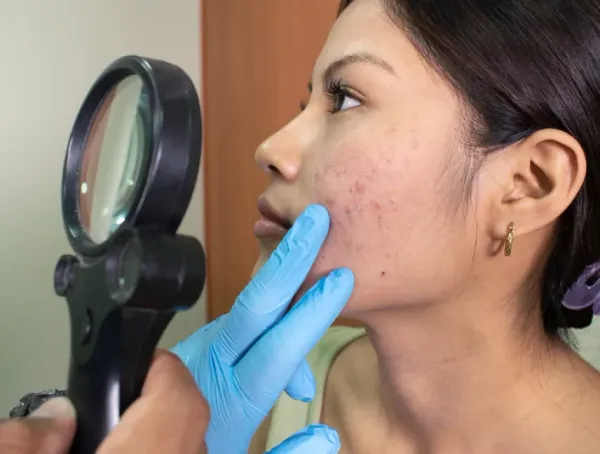 Dermatólogos rechazaron difusión de contenidos sobre salud por parte de influencers ajenos al sector
