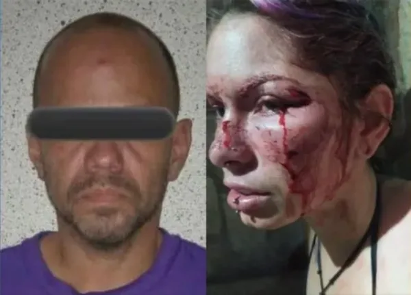 Imputaron a un hombre por intento de feminicidio en Maracay