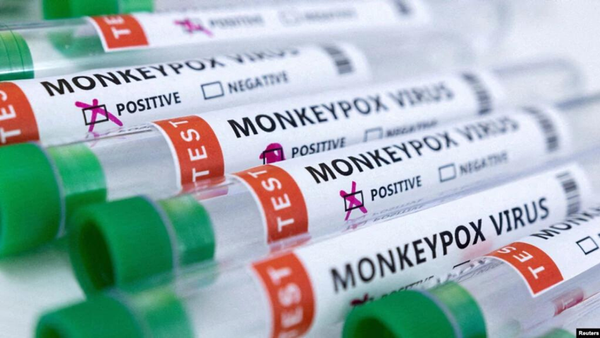 Se reportó la primera muerte relacionada con la viruela del mono en Perú