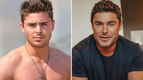 Zac Efron desmintió rumores sobre hacerse cirugías plásticas