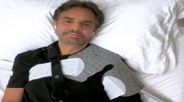 Eugenio Derbez dio detalles sobre el accidente que sufrió