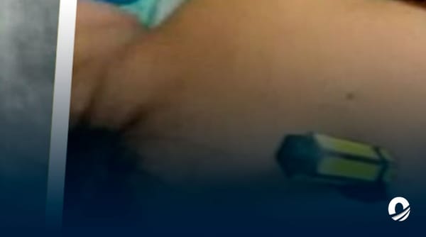 Por celos hombre intentó perforar a su pareja con un destornillador 