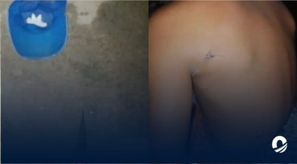 Niño fue apuñalado durante un robo a mano armada en el estado Apure