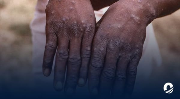 Academia Nacional de Medicina viruela del mono