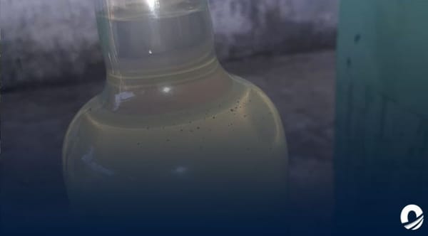 Maturín agua contaminada